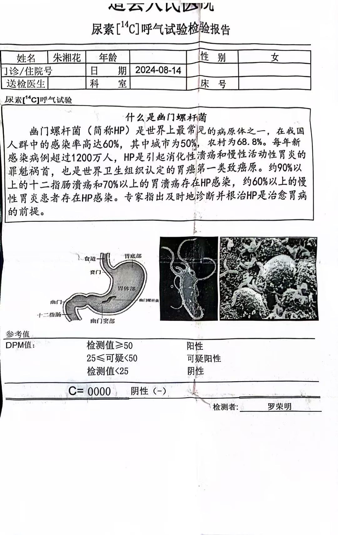 獲得術(shù)前三項